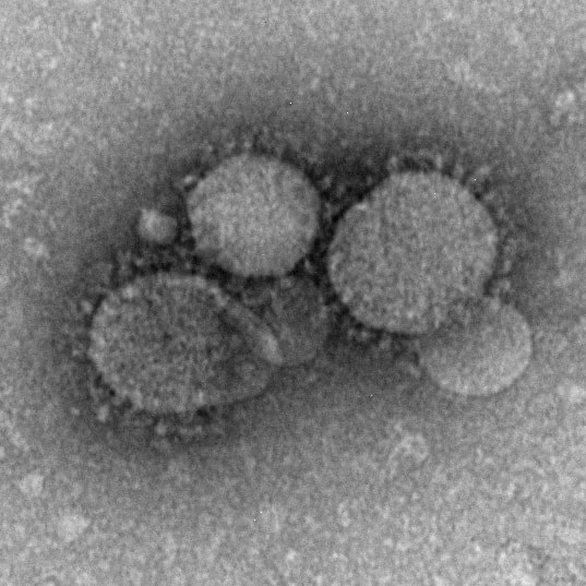 The Centers for Disease Control and Preventon (CDC) explain that the MERS-CoV particles as seen by negative stain electron microscopy. Source: Cynthia Goldsmith/Maureen Metcalfe/Azaibi Tamin